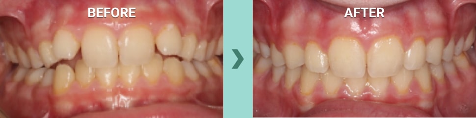 Healthy Start before and after