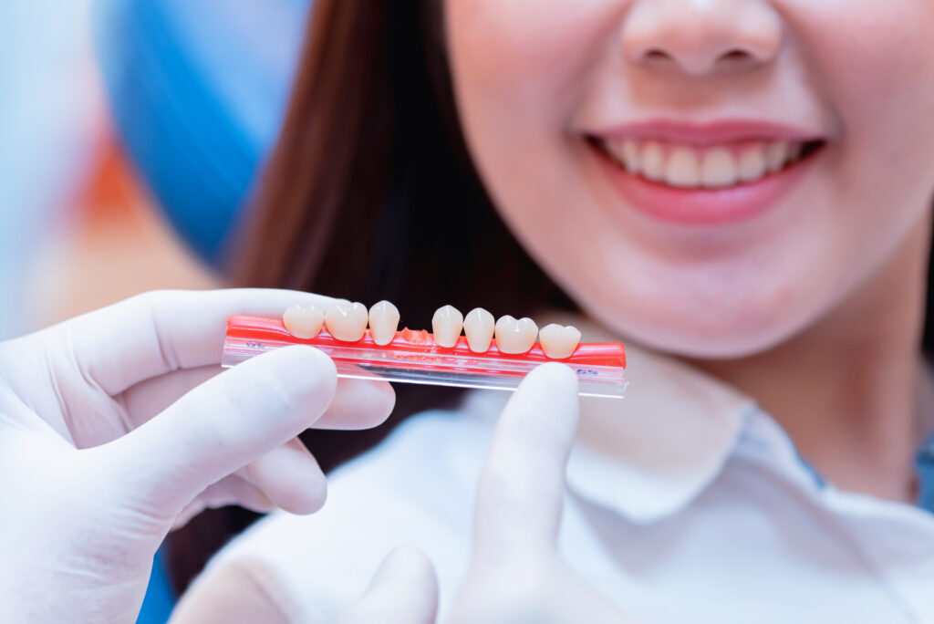 Dental Crowns Boise